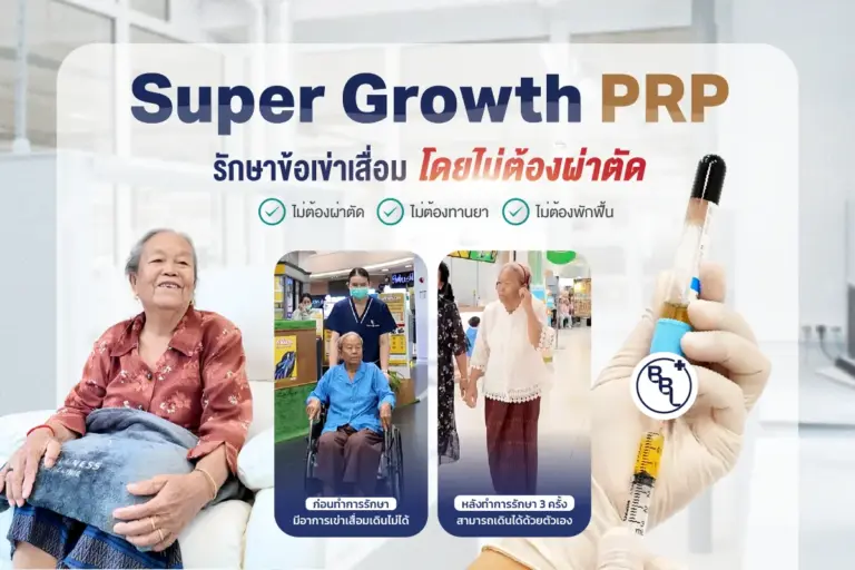 SuperGrowthPRPThumb