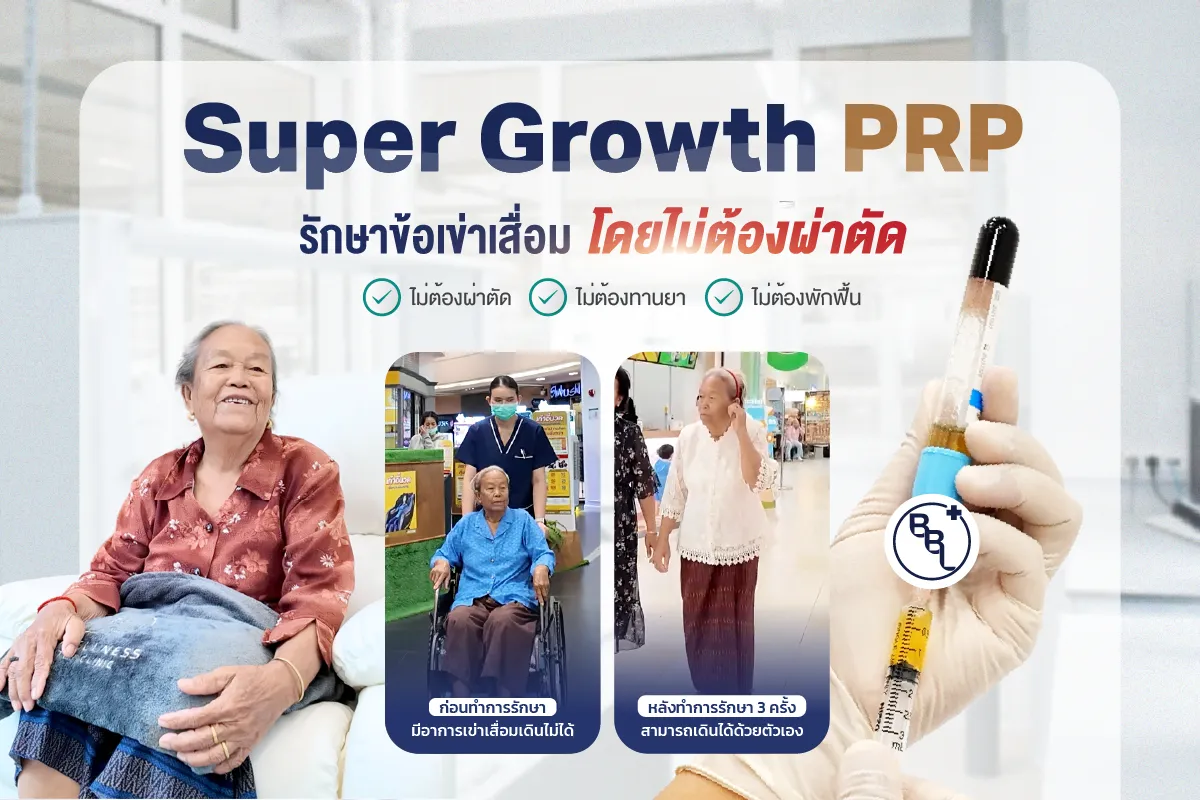 SuperGrowthPRPThumb