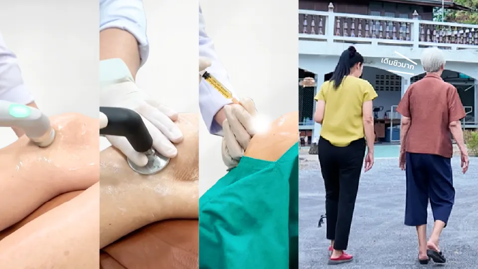 ขั้นตอนการฟื้นฟูข้อเข่าเสื่อมด้วยเครื่อง INDIBA, การฉีด PRP และการเดินจริงหลังรักษา