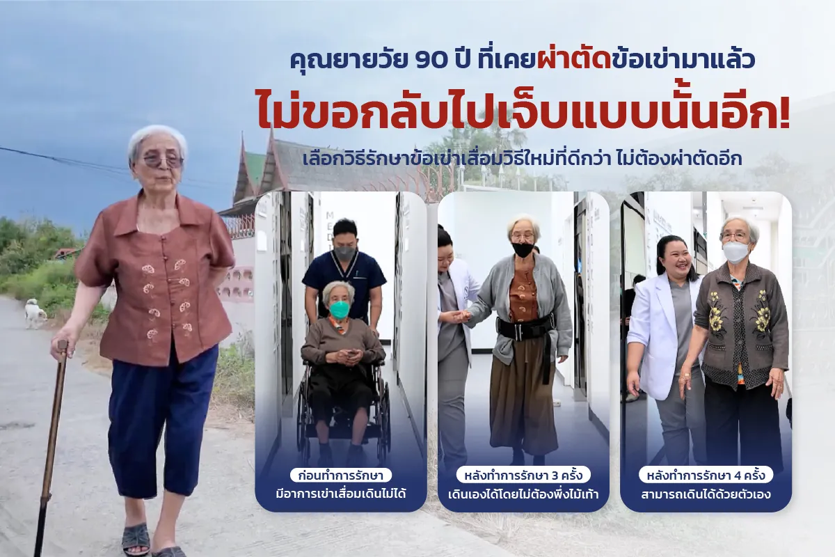 คุณยายวัย 90 ปีเลือกฟื้นฟูข้อเข่าเสื่อมด้วยโปรแกรม BRT ของ BBL Wellness Center หลังเคยผ่านการผ่าตัดมาแล้ว และกลับมาเดินเองได้อีกครั้ง
