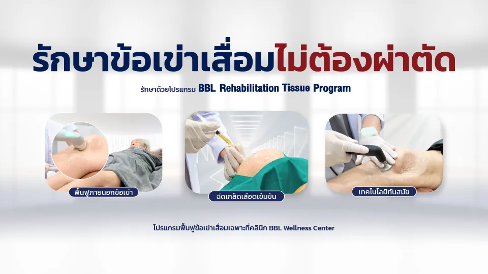 อินโฟกราฟิกแนะนำโปรแกรมฟื้นฟูข้อเข่าเสื่อม BRT ไม่ต้องผ่าตัด ที่คลินิก BBL Wellness Center