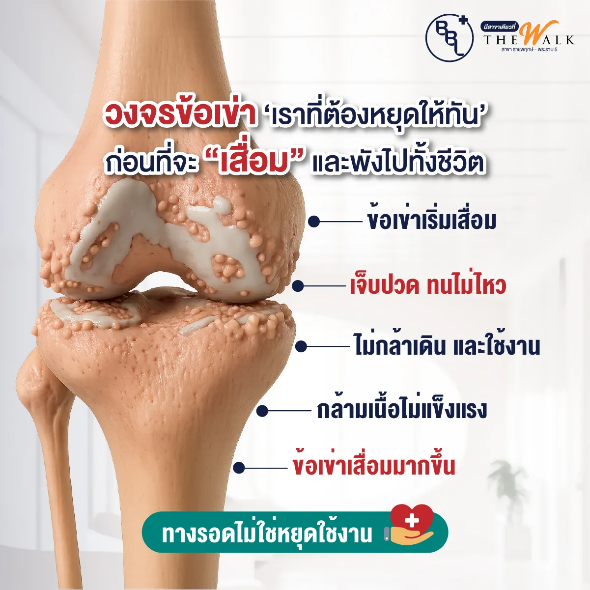 ภาพจำลองวงจรข้อเข่าเสื่อมตั้งแต่เริ่มเจ็บปวดจนข้อพัง พร้อมข้อความเตือนว่าทางรอดไม่ใช่การหยุดใช้งานข้อเข่า
