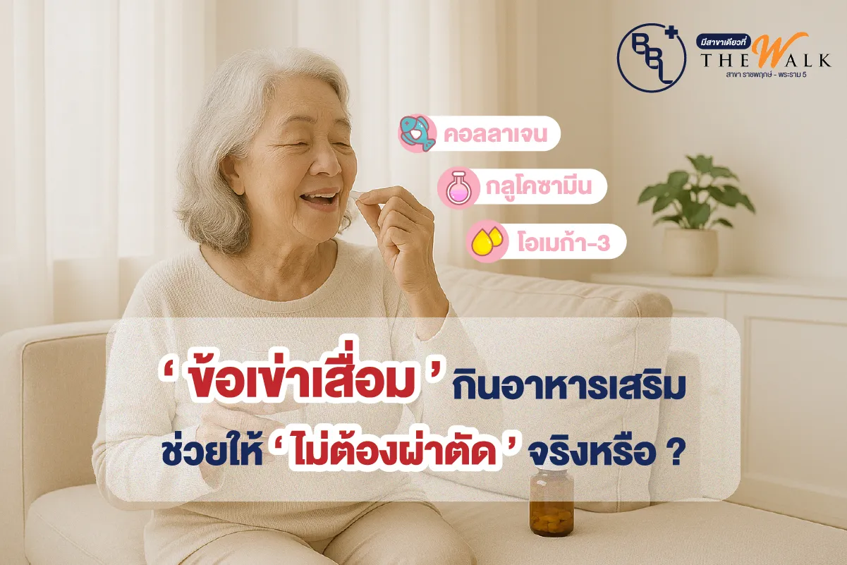 ผู้สูงอายุกินอาหารเสริมบำรุงข้อเข่า เช่น คอลลาเจน กลูโคซามีน โอเมก้า-3 เพื่อลดความเสี่ยงการผ่าตัดข้อเข่าเสื่อม